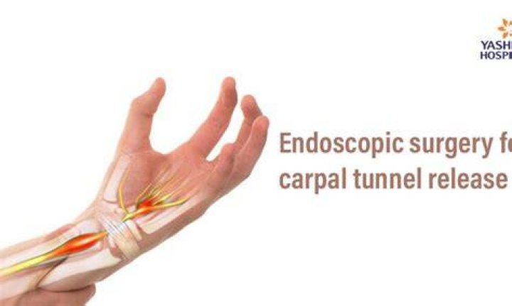 Are you awake during carpal tunnel surgery?