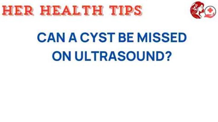 Can a cyst be missed on ultrasound?